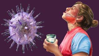 Glandular Fever: Causes And Symptoms