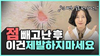 의사가 알려주는 점빼고 흉터 색소침착 남지 않는 후관리 방법 | 흉터, 색소침착