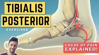 Tibialis Posterior Exercises: Treat the Root Cause of Your Tib Post Pain (PTTD)