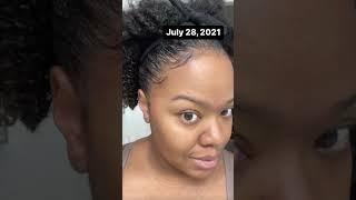 Watch Me Regrow My Edges using the Follicle Stimulating Serum by J.Antoinette 1927. #regrowhairline