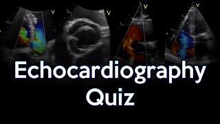 Echocardiography Quiz