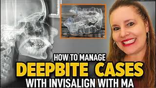 Invisalign with MA Deepbite Cases