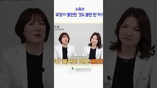 #소음순수술 #소음순비대칭 #소음순모양