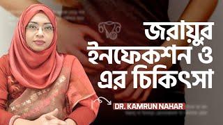 জরায়ুর ইনফেকশন: লক্ষণ, করণীয় ও চিকিৎসা : Dr. Kamrun Nahar| LifeSpring