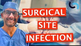 Diagnosis and Treatment of Surgical Site Infection