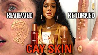 How Winnie Harlow DESTROYED My Face.  (The Cay Skin Disaster is Actually SO BAD)