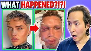 Plastic Surgeon Reacts to 5 Surgeries/1 Day Going HORRIBLY Wrong!
