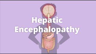 Cirrhosis – Hepatic encephalopathy