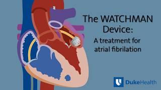 Decreasing Risk of Stroke with the WATCHMAN Device | Duke Health