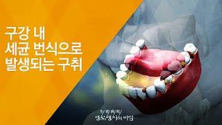 구강 내 세균 번식으로 발생되는 구취 - (20131023_479회 방송)_노인 냄새는 정말 불쾌한가요?