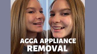 AGGA Appliance Removal | In-Office Sneak Peak! | Ending Phase 2