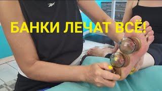 Банки лечат всё! Огненный массаж стопы.  #DIY #massage #health