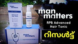 RPB Advanced Hair Tonic Man Matters Review & Results