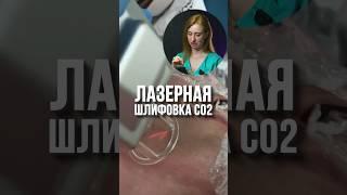 Есть ли эффект от лазерной шлифовки CO2?