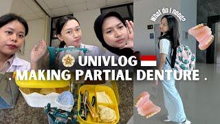 HOW TO MAKE A PARTIAL DENTURE WITH FUN !!! DENTAL STUDENT VLOG  || DENTAL STUDENT LIFE‍️