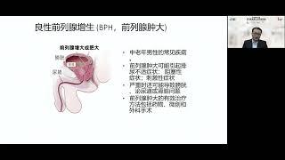 前列腺癌网络讲座 2022