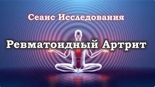 Сеанс исследования: Ревматоидный артрит не приговор! (2024)