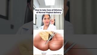 How to take care of Vaginal stitches after delivery | Dr. RITU | Aatman #pregnancy  #viral