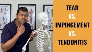 Rotator Cuff Tear VS  Shoulder Impingement VS Shoulder Tendonitis