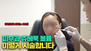 울퉁불퉁 땅콩형 얼굴 개선하는 쥬베룩 볼륨 시술 직접 보여드리겠습니다