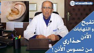 Dr Khalid SNOUSSI | تسوس الأذن: حذاري من التهابات وتقيحات الأذن المزمنة ! | الدكتور خالد غازي سنوسي