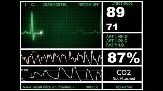 Hospital Monitor with FlatLine (L) (HD)