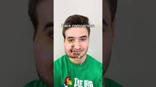 Face Comparison | Before and After