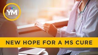 Link between Epstein-Barr virus and MS | Your Morning