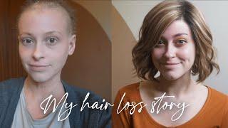 My hair loss story | Thaila Skye