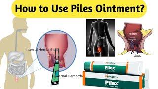 How to Use Piles Ointment