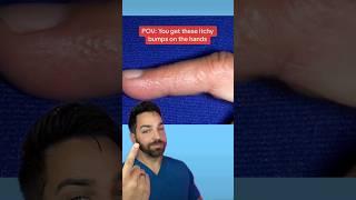 ITCHY BUMPS ON HANDS  | DOCTORLY #shorts