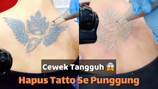 Hapus Tatto Punggung Cewek Tangguh | Laser Tatto Removal