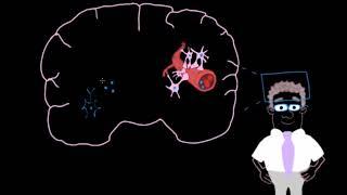 Parkinson Hastalığı için İlaç Tedavisi (Sağlık Bilgisi ve Tıp)