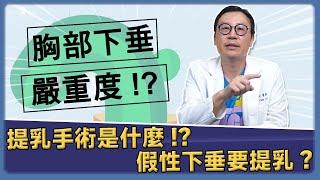 提乳手術是什麼? 乳房下垂居然還有分嚴重度! 我該提乳嗎?｜巨星整形外科｜林正宜醫師