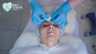 HYDRAFACIAL