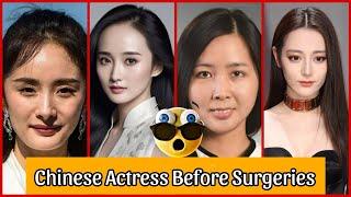 Chinese Actress Before And After Plastic Surgeries  Incredible Changes  2024