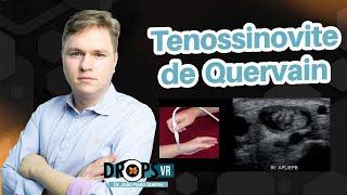 TENOSSINOVITE DE QUERVAIN I VOCÊ RADIOLOGISTA