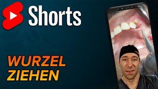 Wurzelrest ziehen #shorts