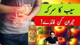 Dr. Zee:Amazing Benefits of Apple Cider Vinegar (ACV) | डॉक्टर ज़ी