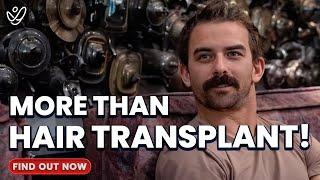 Hair Transplant in Turkey | Experience of Logan Lisle