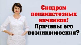 Что такое синдром поликистозных яичников?