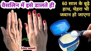 वैसलीन में इसे डालते ही 60 साल के बूढ़े हाथ चेहरा भी जवान हो जाएगा II No Wrinkle problem