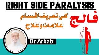 Right Side Paralysis/دائیں طرف کا فالج/Hemiplegia/Homeopathic Medicines/Dr Arbab.