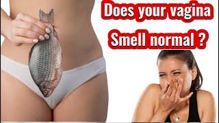 Vagina Smell / Does Your Vagina Smell Normal ? Smelly Vaginal Discharge. Cause and Treatment, Thrush
