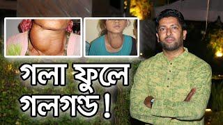 গলার সম্মুখ ভাগের থাইরয়েড গ্রন্থি ফুলে যাবার কারণ, উপসর্গ ও প্রতিকার । thyroid । Md Latiful Bari