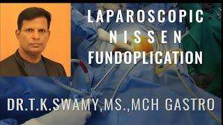 LAPAROSCOPIC NISSEN FUNDOPLICATION