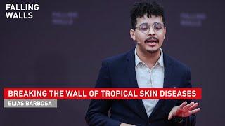 Elias Barbosa: Breaking the Wall of Tropical Skin Diseases