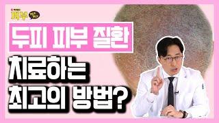 두피에 생긴 각질, 염증 없애고 싶다면 이렇게 관리하세요! - 박치영의 피부 톡톡 #66 두피 각질