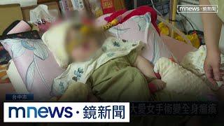 控醫院8分鐘無作為　2月大愛女手術變全身癱瘓｜#鏡新聞