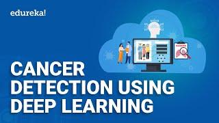 Cancer Detection Using Deep Learning | Deep Learning Projects | Deep Learning Training | Edureka